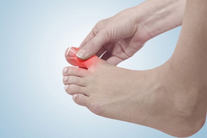 Cách chẩn đoán bệnh qua dấu hiệu bàn chân chính xác đến không ngờ ảnh 3 Cách chẩn đoán bệnh qua dấu hiệu bàn chân chính xác đến không ngờ ảnh 3